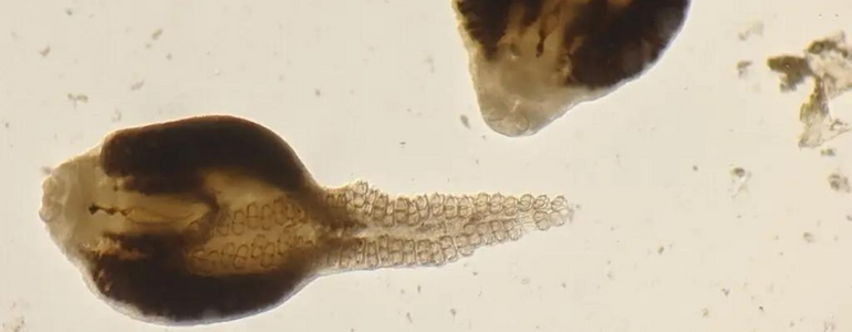 Monogenean worms (Microcotyle sebastis) that were dissected from the gills of a preserved copper rockfish from the Burke Museum specimen collection.Credit...Katie Leslie/University of Washington